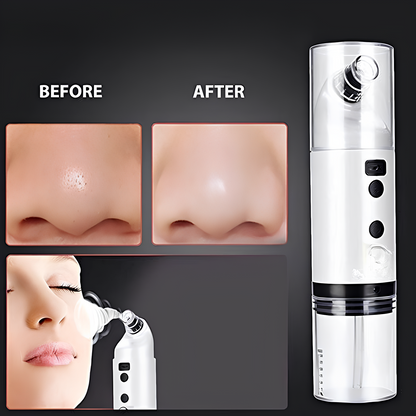 Lunavaé™ Beauty Device – Mini Facial Cleaner