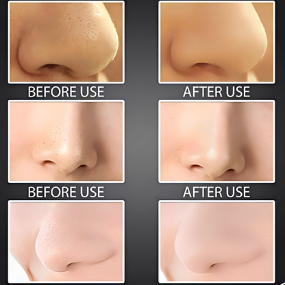 Lunavaé™ Beauty Device – Mini Facial Cleaner