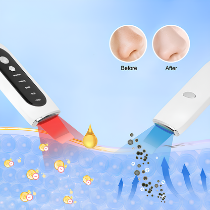 Lunavaé™ Remover Device – Deep Skin Cleanser