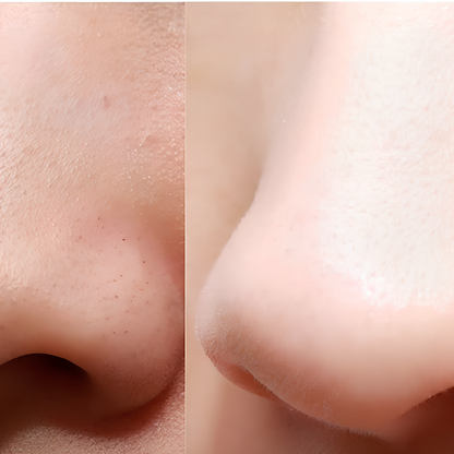 Lunavaé™ Remover Device – Deep Skin Cleanser